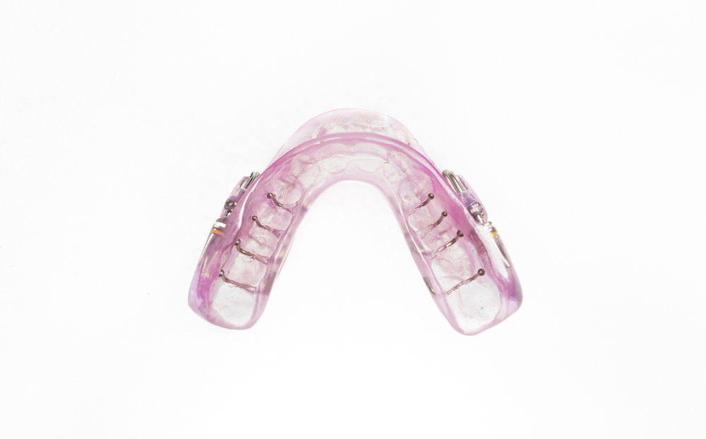 Schnarchtherapie_Dentallabor_Wuppertal